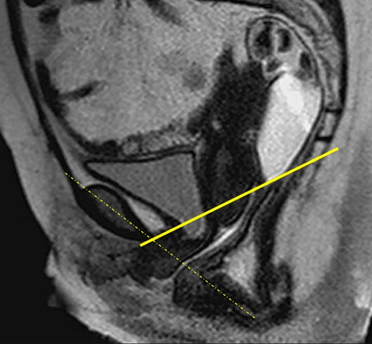 Rotación Hands On en Vivo en RM de Pelvis Ginecológica